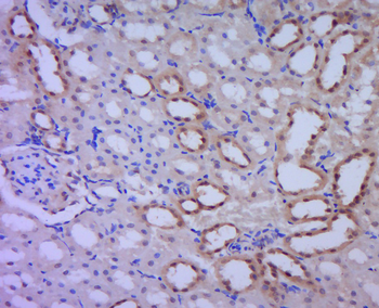 Alpha-synuclein (nitro-Tyr39) Rabbit Polyclonal Antibody
