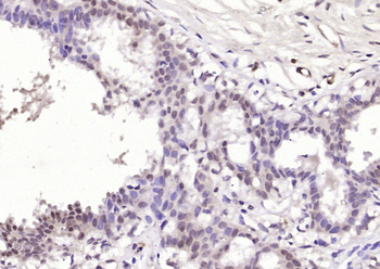 AMIGO2 Rabbit Polyclonal Antibody