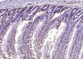 AMIGO2 Rabbit Polyclonal Antibody