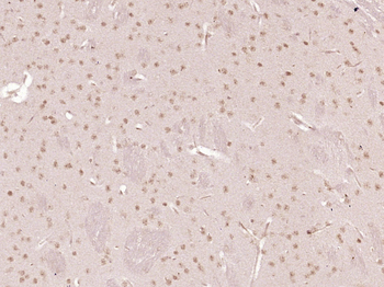 Phospho-AMPK alpha 1 (Ser487) Rabbit Polyclonal Antibody