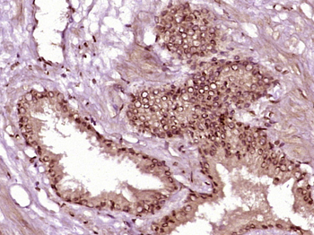 Phospho-AR/Androgen receptor (Ser515) Rabbit Polyclonal Antibody