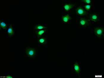 Phospho-AR/Androgen receptor (Ser515) Rabbit Polyclonal Antibody