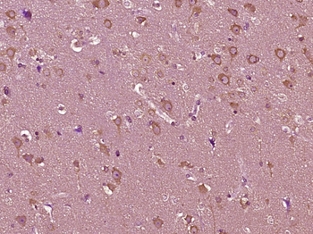 Phospho-AR/Androgen receptor (Ser94) Rabbit Polyclonal Antibody