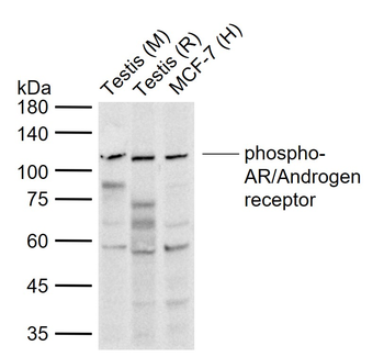 Phospho-AR/Androgen receptor (Tyr363) Rabbit Polyclonal Antibody