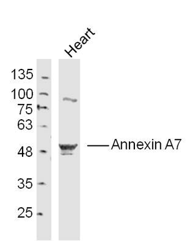 Annexin A7 Rabbit Polyclonal Antibody