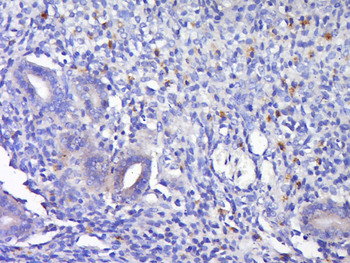 Annexin VI Rabbit Polyclonal Antibody