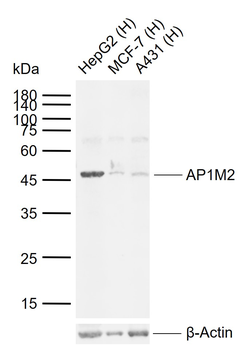 AP1M2 Rabbit Polyclonal Antibody