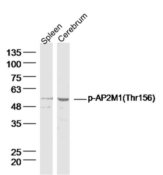 Phospho-AP2M1 (Thr156) Rabbit Polyclonal Antibody