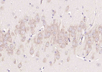 Phospho-APC (Ser2054) Rabbit Polyclonal Antibody