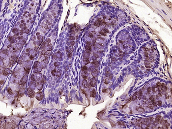 Phospho-APC (Ser2054) Rabbit Polyclonal Antibody