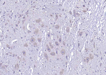 Phospho-APC (Ser2054) Rabbit Polyclonal Antibody