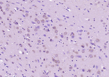 APC10 Rabbit Polyclonal Antibody