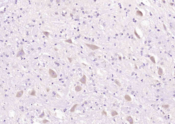 APOD Rabbit Polyclonal Antibody
