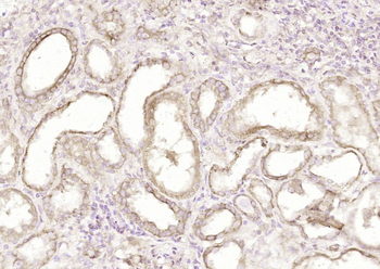 APOL1 Rabbit Polyclonal Antibody