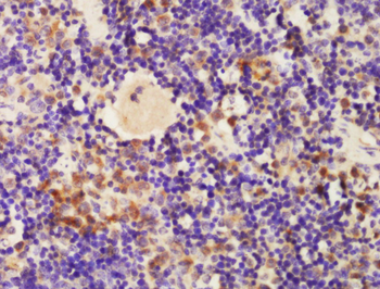 Apolipoprotein CII/APOC2 Rabbit Polyclonal Antibody