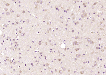 APPBP1 Rabbit Polyclonal Antibody