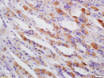 APRT Rabbit Polyclonal Antibody