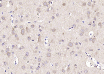 ARF1 Rabbit Polyclonal Antibody