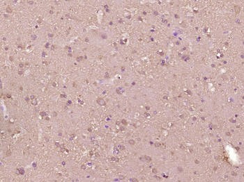 Arginase II Rabbit Polyclonal Antibody