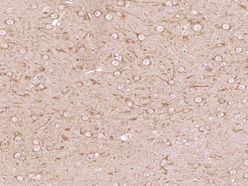 Arginase II Rabbit Polyclonal Antibody