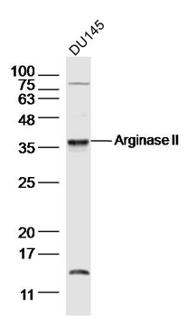 Arginase II Rabbit Polyclonal Antibody