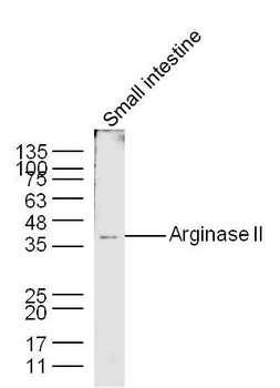 Arginase II Rabbit Polyclonal Antibody