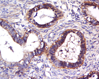 ARPC1A Rabbit Polyclonal Antibody