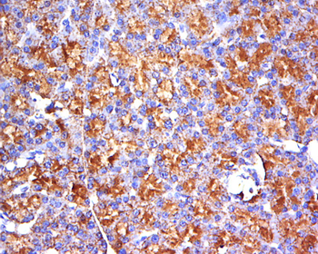 ARPC1A Rabbit Polyclonal Antibody