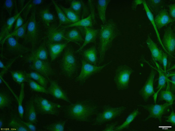 ASCL2 Rabbit Polyclonal Antibody