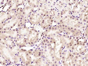 Phospho-Ataxin 1 (Ser775) Rabbit Polyclonal Antibody