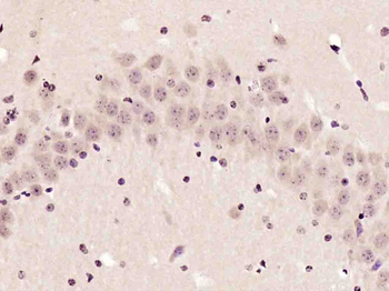 Phospho-Ataxin 1 (Ser775) Rabbit Polyclonal Antibody