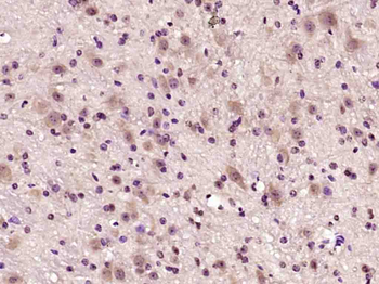 Phospho-Ataxin 1 (Ser775) Rabbit Polyclonal Antibody