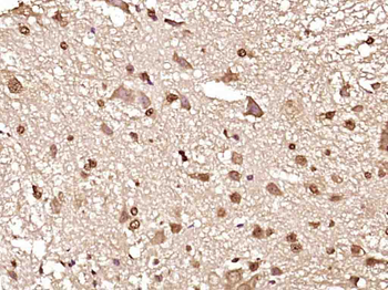 Phospho-Ataxin 1 (Ser775) Rabbit Polyclonal Antibody