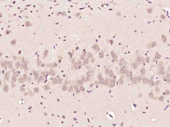 Phospho-Ataxin 1 (Ser775) Rabbit Polyclonal Antibody