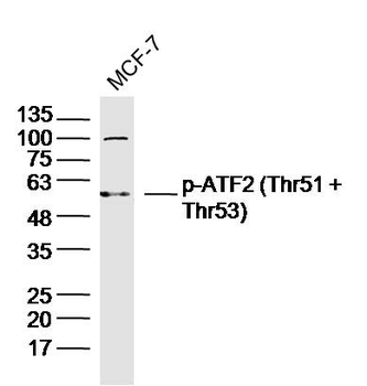 Phospho-ATF2 (Thr51 + Thr53) Rabbit Polyclonal Antibody