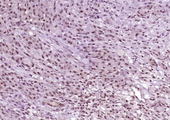 Phospho-ATM (Ser794) Rabbit Polyclonal Antibody