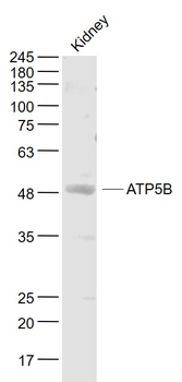 ATP5B Rabbit Polyclonal Antibody