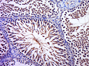 Phospho-BRAF (Thr598 + Ser601) Rabbit Polyclonal Antibody