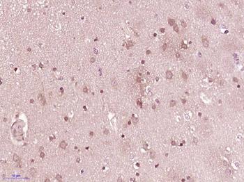 B7-H6 Rabbit Polyclonal Antibody