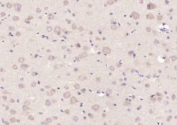BACE2 Rabbit Polyclonal Antibody