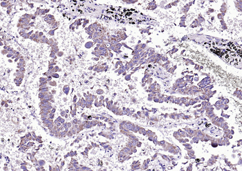 Phospho-BAD (Ser91) Rabbit Polyclonal Antibody