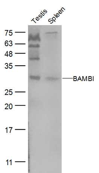 BAMBI Rabbit Polyclonal Antibody