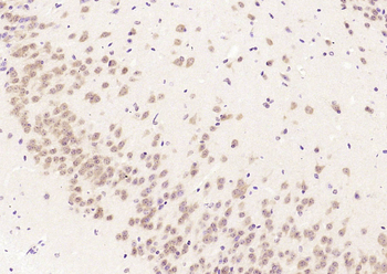 BBS1 Rabbit Polyclonal Antibody
