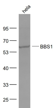 BBS1 Rabbit Polyclonal Antibody