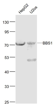 BBS1 Rabbit Polyclonal Antibody