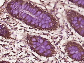 TTC8 Rabbit Polyclonal Antibody