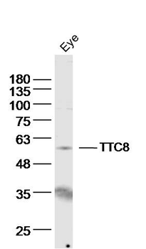 TTC8 Rabbit Polyclonal Antibody