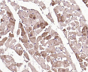 BBS9 Rabbit Polyclonal Antibody