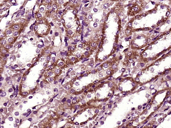 BBS9 Rabbit Polyclonal Antibody