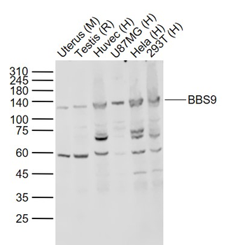 BBS9 Rabbit Polyclonal Antibody